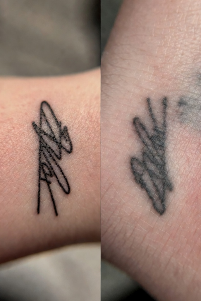 Does Size Affect How Long a Tattoo Lasts?